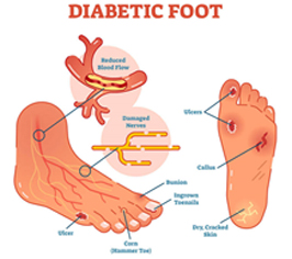 Diabetic Foot Care Clinic in Mumbai
