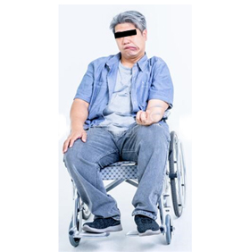 Stroke Specialist Surgeon in Mumbai